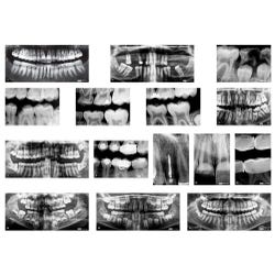 Image for Roylco Dental X-Rays and Charts, 17 Pieces from School Specialty